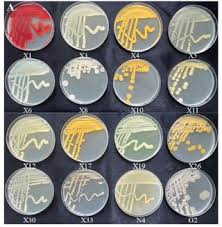 Attēlu rezultāti vaicājumam “Sanionia uncinata  sporophyte”