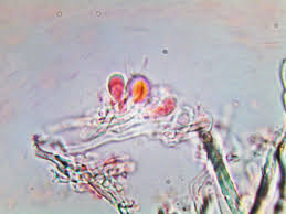 Attēlu rezultāti vaicājumam “Elmerina caryae”