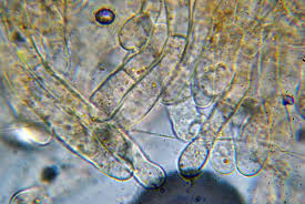 Attēlu rezultāti vaicājumam “Octospora humosa”