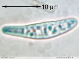 Attēlu rezultāti vaicājumam “Opegrapha rufescens”