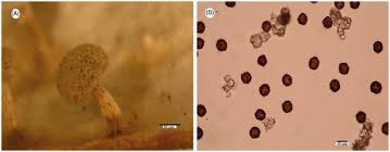 Attēlu rezultāti vaicājumam “Diderma deplanatum spores”