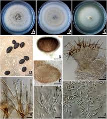 Attēlu rezultāti vaicājumam “Ombrophila violacea spores”
