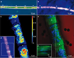 Attēlu rezultāti vaicājumam “Heterotrichia pomiformis (syn. Arcyria pomiformis) macro”