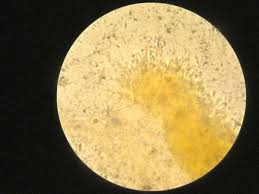 Attēlu rezultāti vaicājumam “Orbilia sp.”