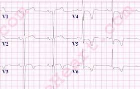 Image result for  ^ L V [ h    