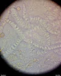 Attēlu rezultāti vaicājumam “Lycogala fuscoolearium macro”