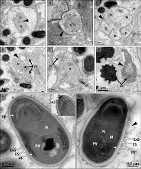 Attēlu rezultāti vaicājumam “Badhamia affinis var. microspora macro”