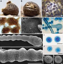 Attēlu rezultāti vaicājumam “Lycogala exiguum aggr.”