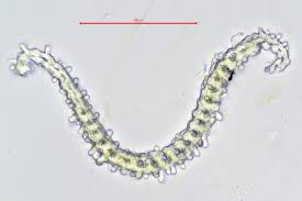 Attēlu rezultāti vaicājumam “Racomitrium canescens sporophyte”