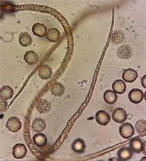 Attēlu rezultāti vaicājumam “Licea chelonoides spores”