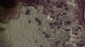 Attēlu rezultāti vaicājumam “Physarum globuliferum spores”