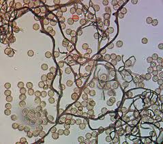 Attēlu rezultāti vaicājumam “Stemonitopsis amoena spores”