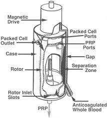 Image result for Autopheresis C