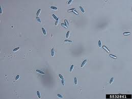 Attēlu rezultāti vaicājumam “Colloderma oculatum spores”