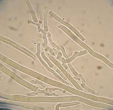 Attēlu rezultāti vaicājumam “Antrodia malicola”