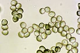 Attēlu rezultāti vaicājumam “Reticularia lycoperdon spores”