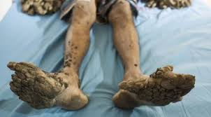 Image result for Lewandowsky-Lutz