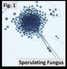 Attēlu rezultāti vaicājumam “Seligeria donniana sporophyte”