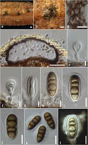 Attēlu rezultāti vaicājumam “Rosellinia desmazieri spores”