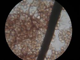 Attēlu rezultāti vaicājumam “Reticularia lobata spores”