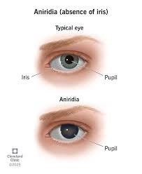 Image result for Iris