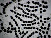 Attēlu rezultāti vaicājumam “Biscogniauxia marginata”