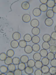 Attēlu rezultāti vaicājumam “Licea pusilla sessile”