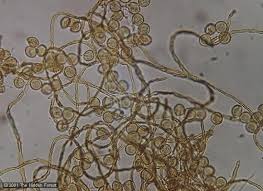 Attēlu rezultāti vaicājumam “Perichaena depressa spores”