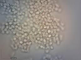 Attēlu rezultāti vaicājumam “Hypocrea pulvinata”