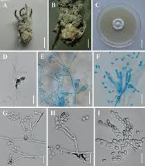 Attēlu rezultāti vaicājumam “Akanthomyces aculeatus”