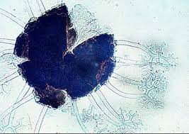 Attēlu rezultāti vaicājumam “Badhamia affinis var. microspora”