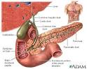Gallstones and gallbladder disease - Introduction