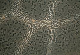 Attēlu rezultāti vaicājumam “Craterium aureum stalked”