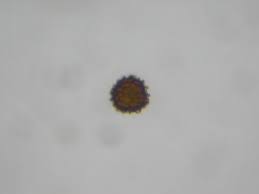 Attēlu rezultāti vaicājumam “Fossombronia foveolata spores”