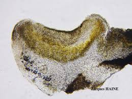 Attēlu rezultāti vaicājumam “Parmeliopsis ambigua”