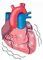<b>Morte Improvvisa</b> e Arresto Cardiaco - Prevenzione