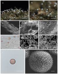 Attēlu rezultāti vaicājumam “Physarum bryomacrocarpum spores”