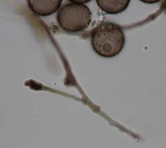 Attēlu rezultāti vaicājumam “Didymium melanospermum spores”