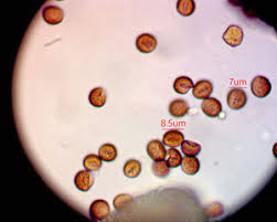 Attēlu rezultāti vaicājumam “Fuligo luteonitens”