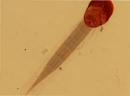 Attēlu rezultāti vaicājumam “Phronia sp. larva”