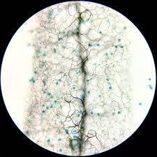 Attēlu rezultāti vaicājumam “Stemonitopsis gracilis young”