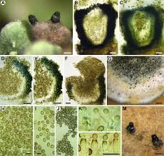 Attēlu rezultāti vaicājumam “Lichenoconium xanthoriae”
