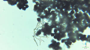 Attēlu rezultāti vaicājumam “Stemonitopsis hyperopta var. landewaldii”