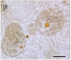 Attēlu rezultāti vaicājumam “Lycogala miserum”