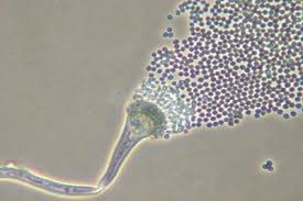 Attēlu rezultāti vaicājumam “Badhamiopsis praetermissa spores”