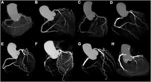 Image result for Hemonetics CCS