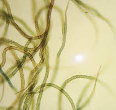 Attēlu rezultāti vaicājumam “Hemitrichia decipiens young”