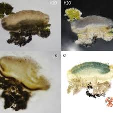 Attēlu rezultāti vaicājumam “Trapeliopsis flexuosa”