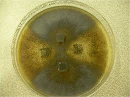 Attēlu rezultāti vaicājumam “Sordaria fimicola”