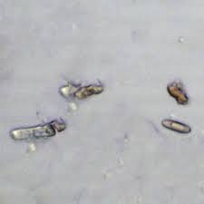 Attēlu rezultāti vaicājumam “Lentaria”